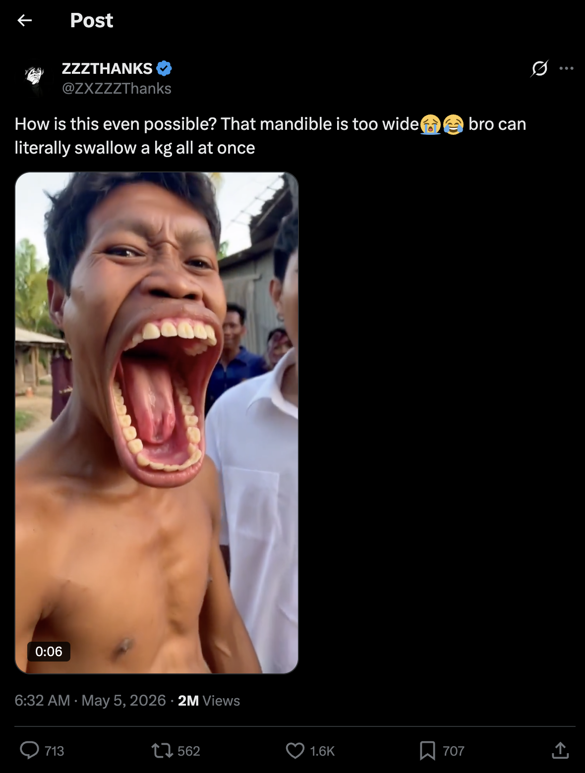 Original tweet by @ZXZZZThanks: How is this even possible? That mandible is too wide